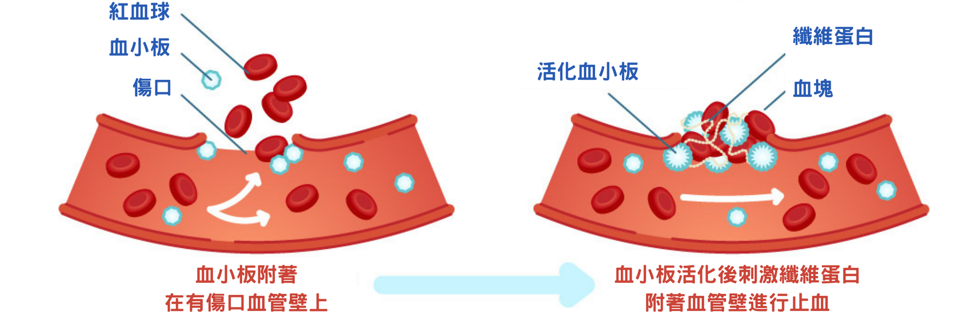 血小板示意圖